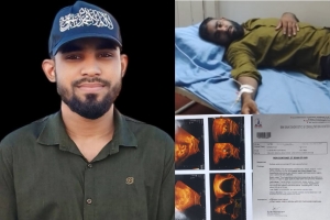 আমি বাঁচতে চাই,দুই কিডনিতে পাথর, টাকার অভাবে থমকে আছে ছাতকের লোকমানের চিকিৎসা